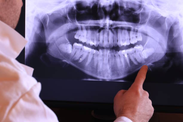 Emergency Dental Services for Seniors